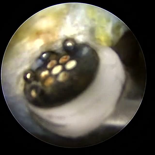 Endoscopic operative field