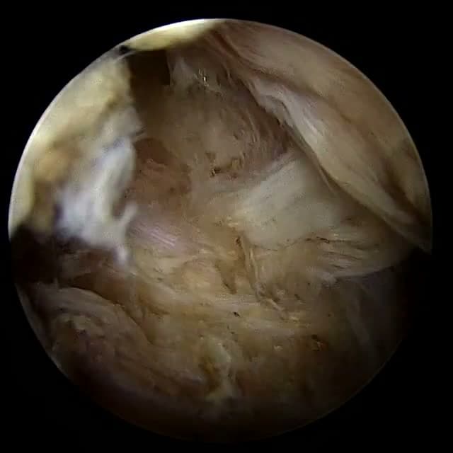 Endoscopic operative field