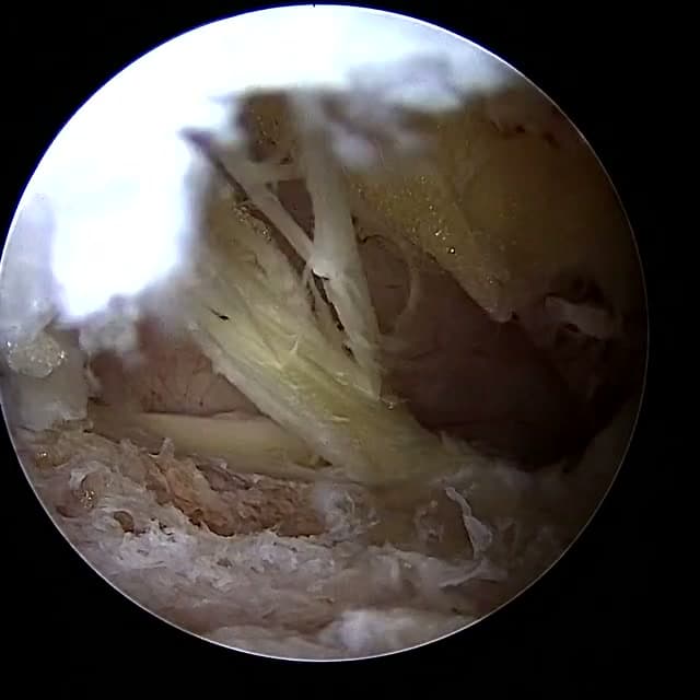 Endoscopic operative field
