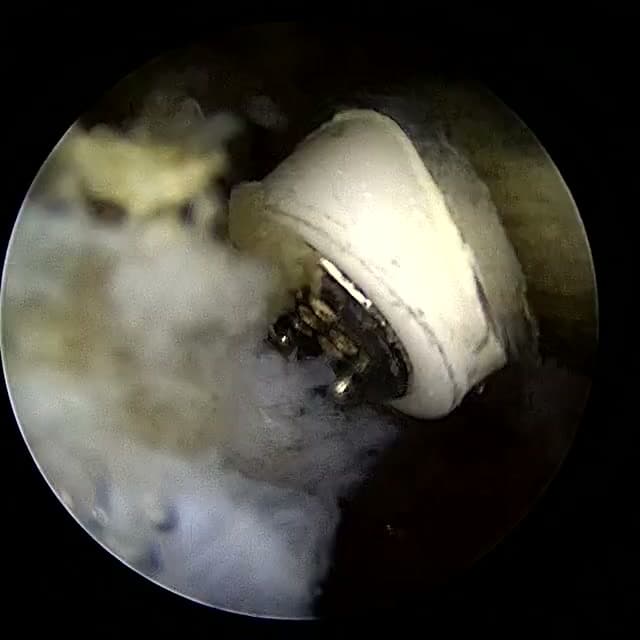 Endoscopic operative field