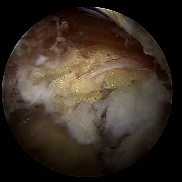 Endoscopic operative field