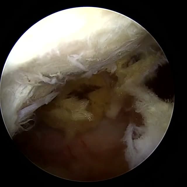 Endoscopic operative field