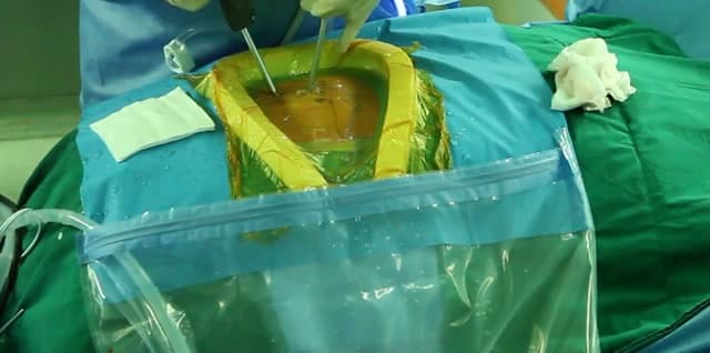 Cropped operative field with instruments